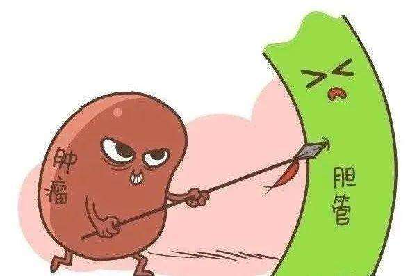 重庆市中医馆治疗胆管癌效果好不好