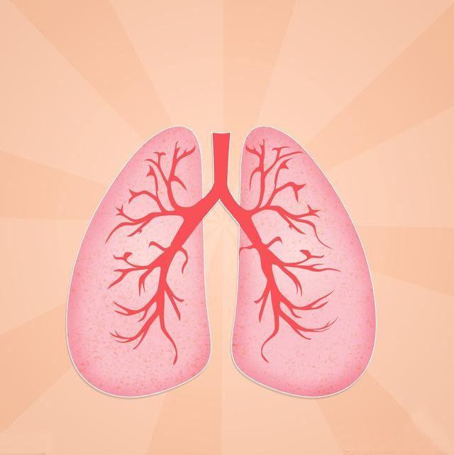 支气管扩张的症状是什么