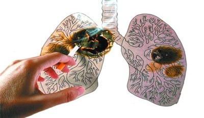 肺癌容易向哪些部位转移？你必须知道的事！
