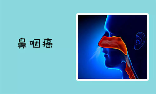 怎样降低鼻咽癌复发的可能性？重庆御和堂老中医讲解