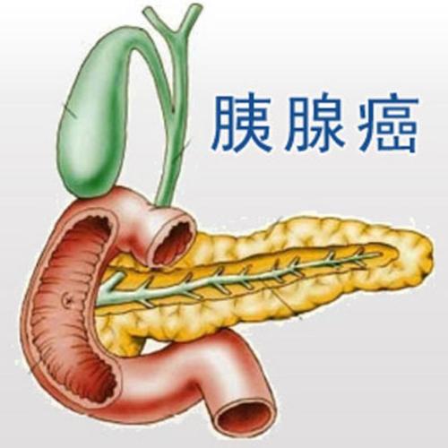 胰腺癌常见发病原因有哪些？重庆市中医院哪家比较好？